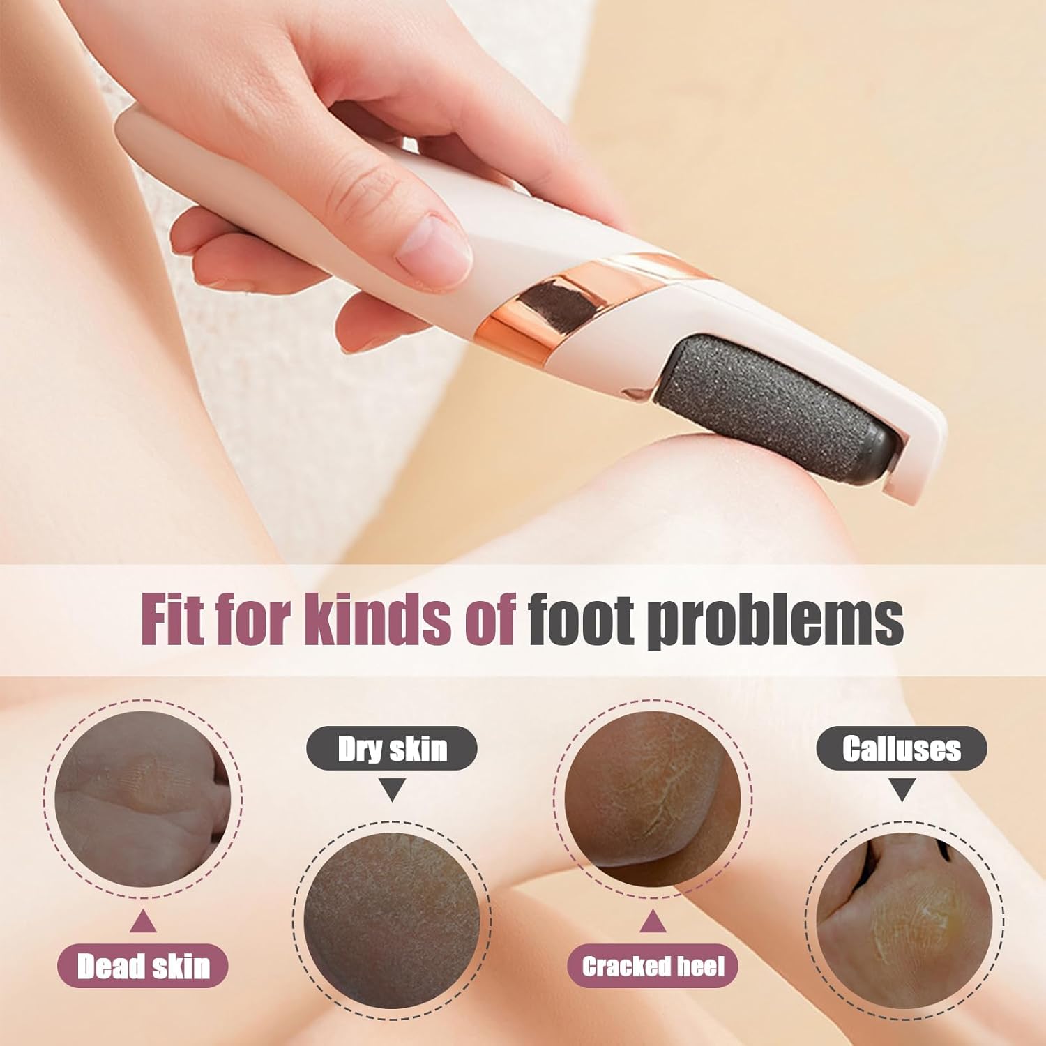 Rechargeable Electric Foot File Callus Remover for Smooth Feet